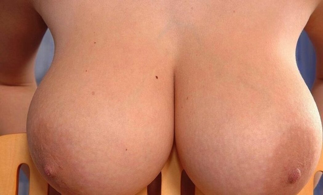 Huge Tits In Stretch Marks