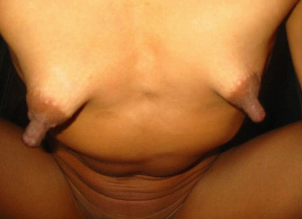 Long Tits WITH LONG Nipples
