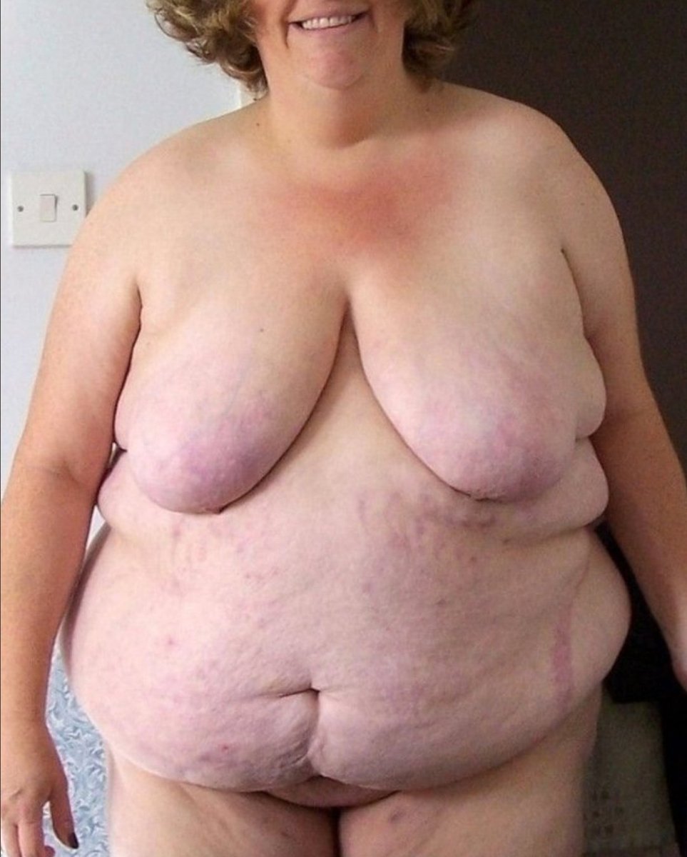 Fat Women With Saggy Tits