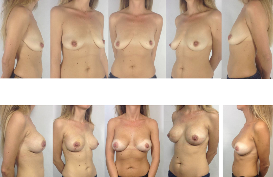 Boobs Sizes Naked
