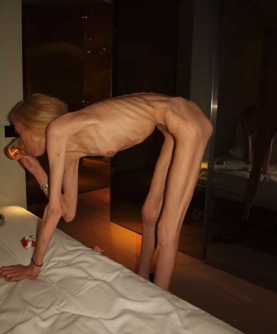 Very Anorexic Porn