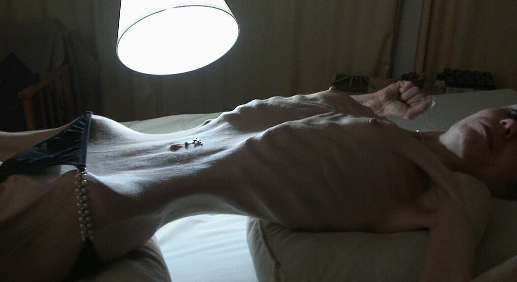 Anorexic Nude Girl