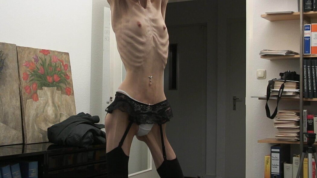Anorexic Nude Girl