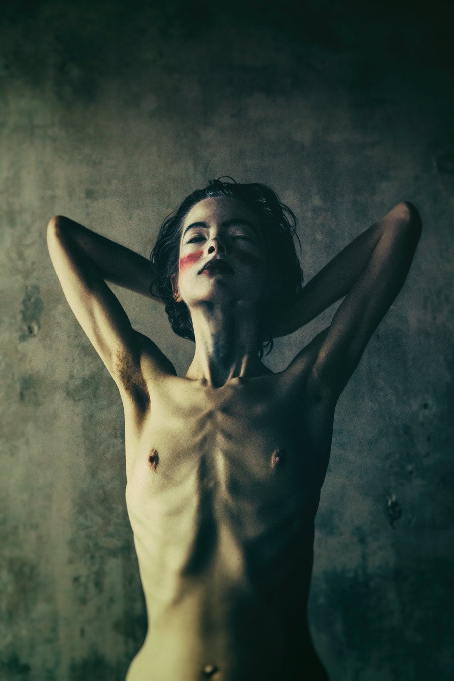 Anorexic Nude Girl
