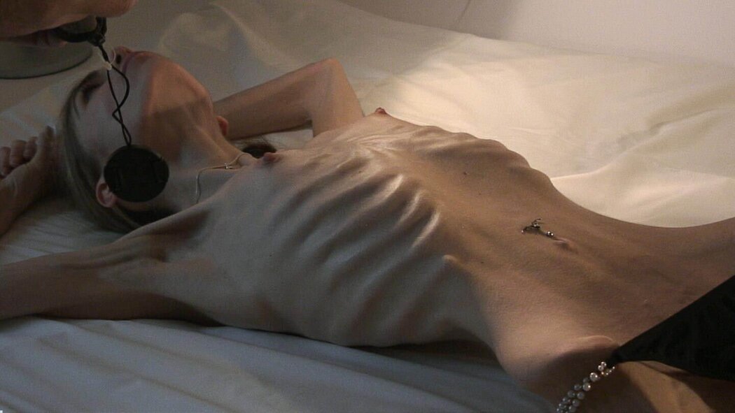 Anorexic Nude Girl