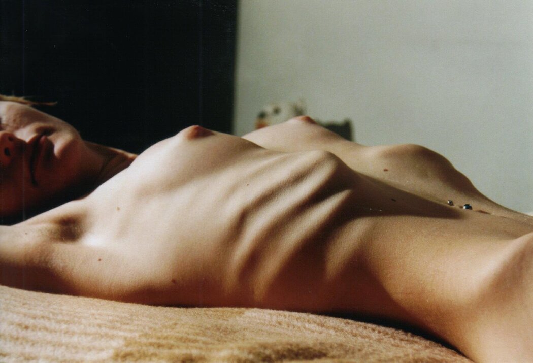 Anorexic Nude Girl