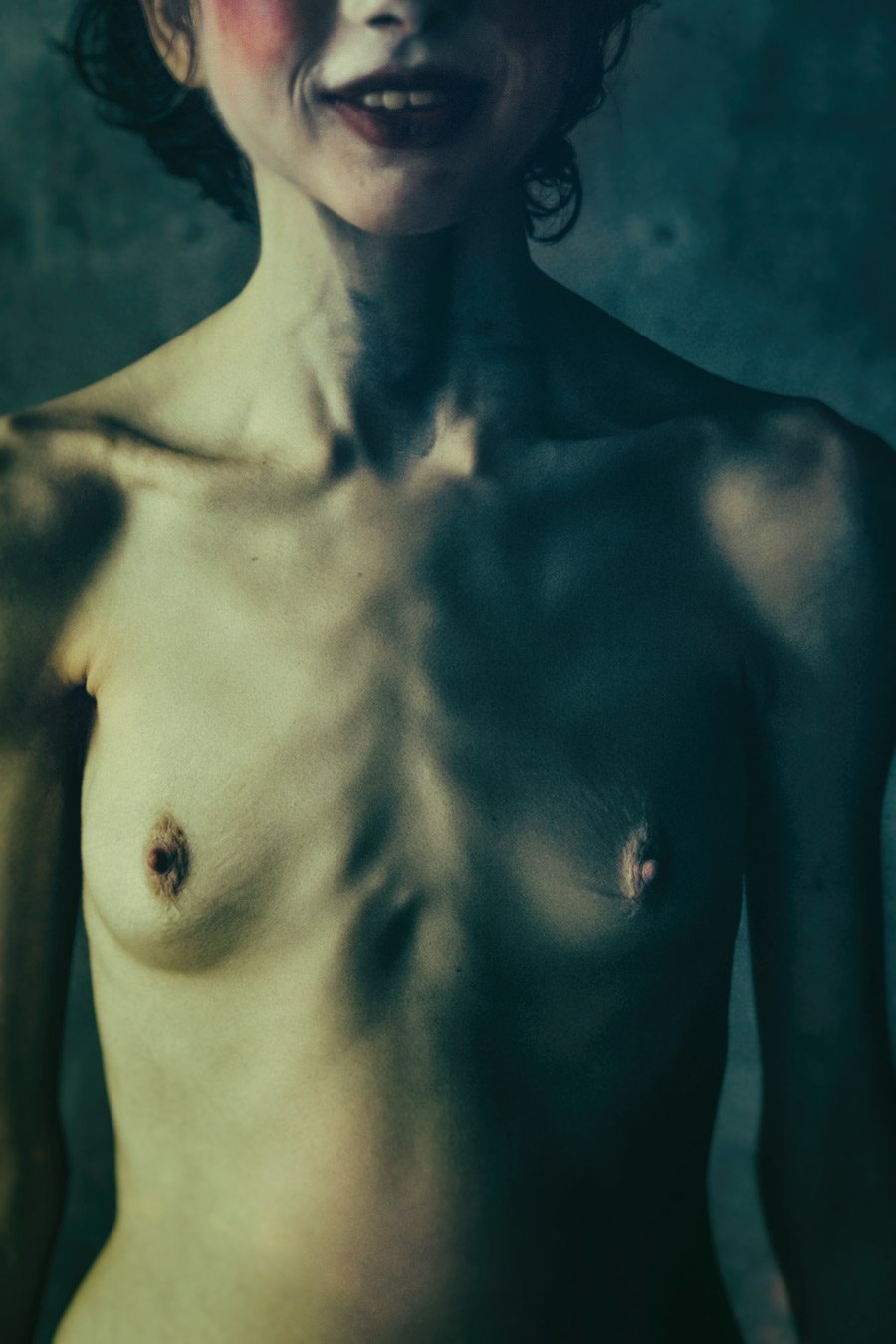 Anorexic Nude Girl