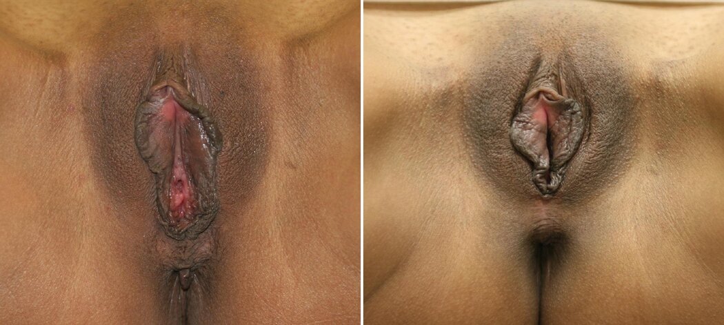 Deep Vagina Porn