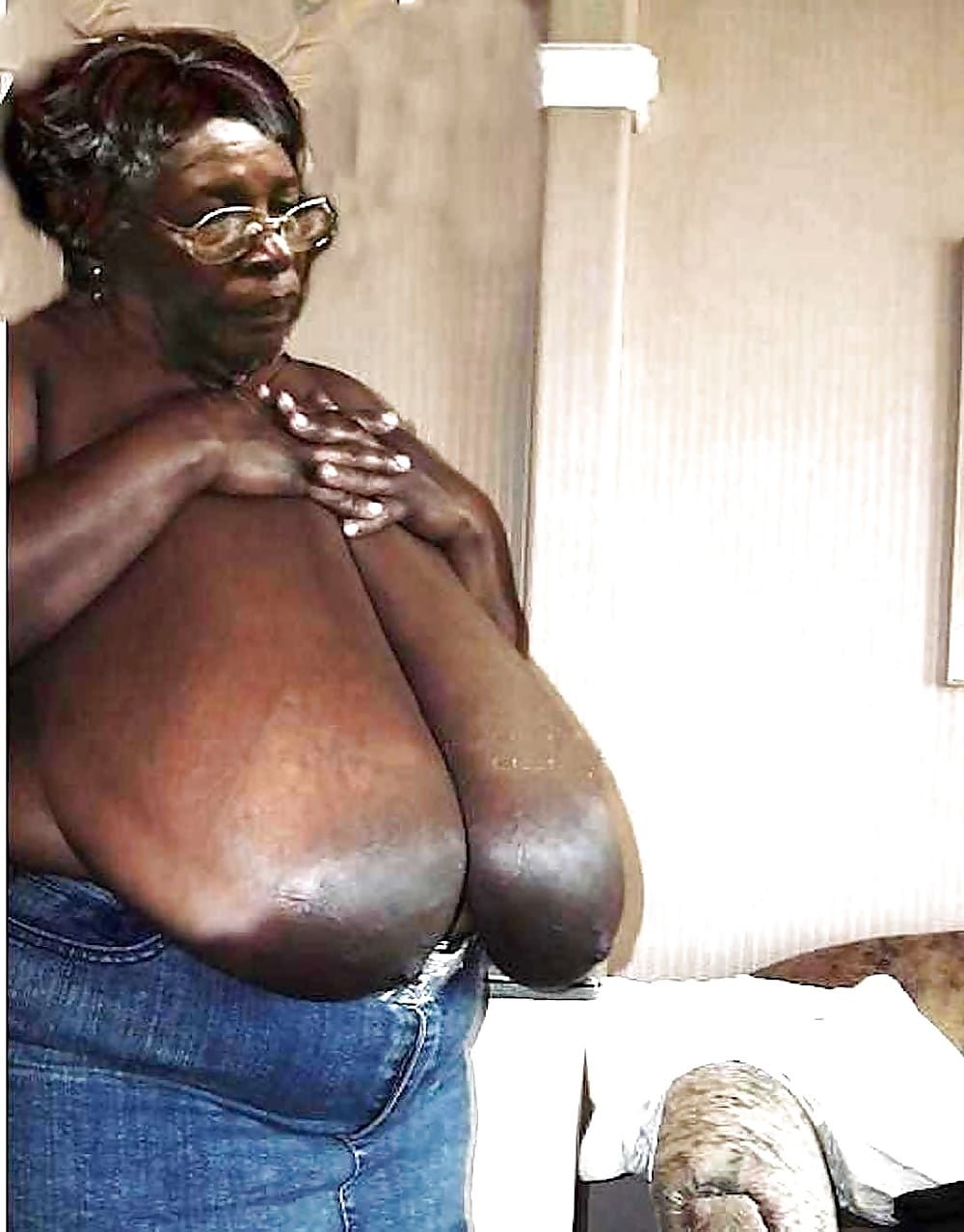 Macromastia Boobs Pics