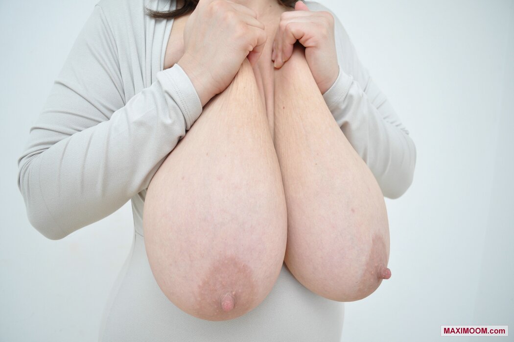 Macromastia Boobs Pics