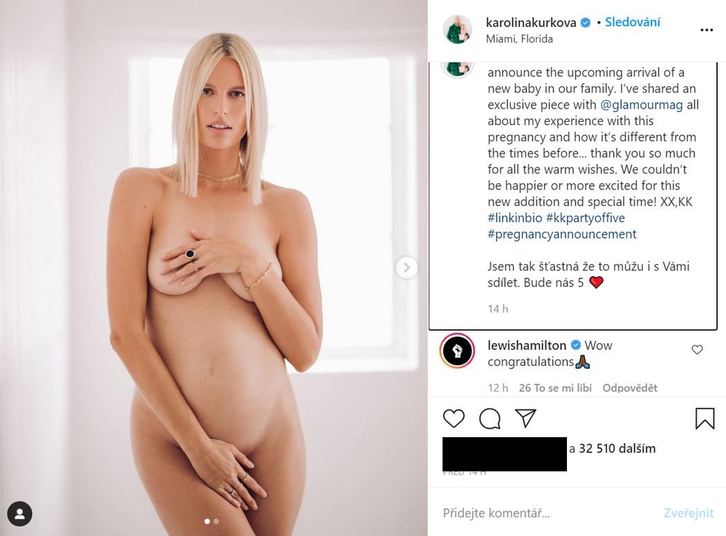 Karolina Kurkova Naked