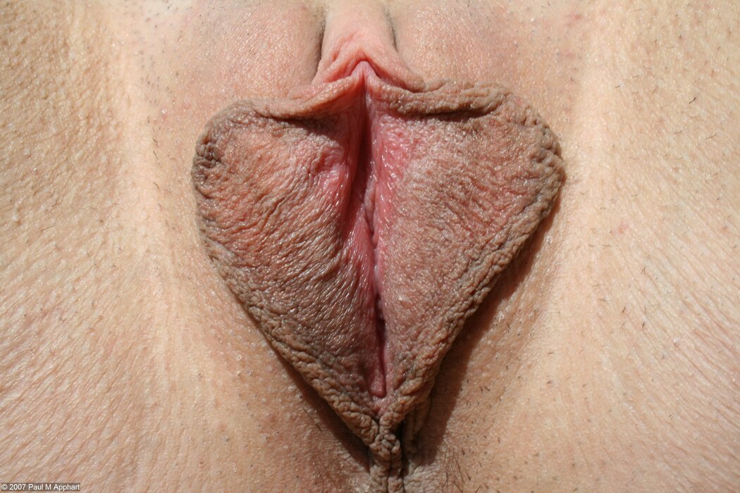 Huge Labia Close Up