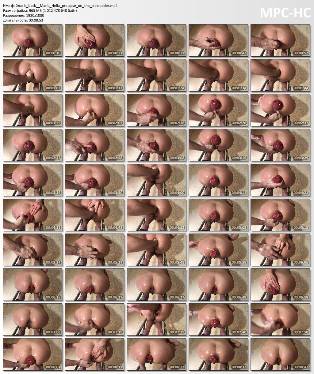 Prolapse Maria Hella
