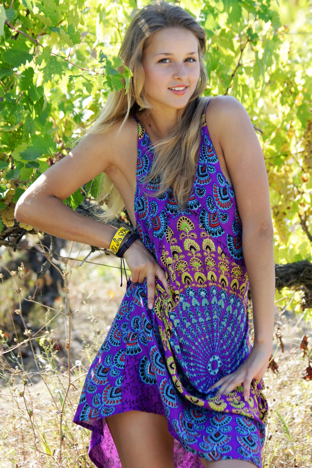 MetArt Toxic A – Vivido Part01 (61P)