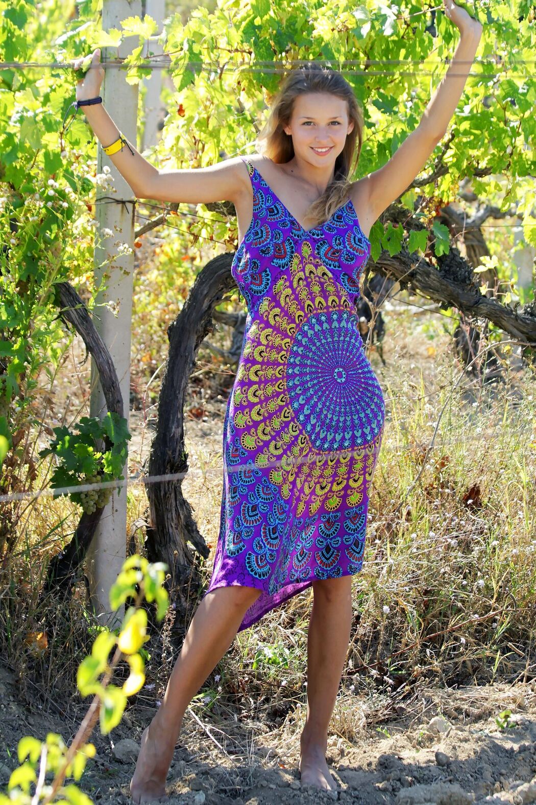 MetArt Toxic A – Vivido Part01 (61P)