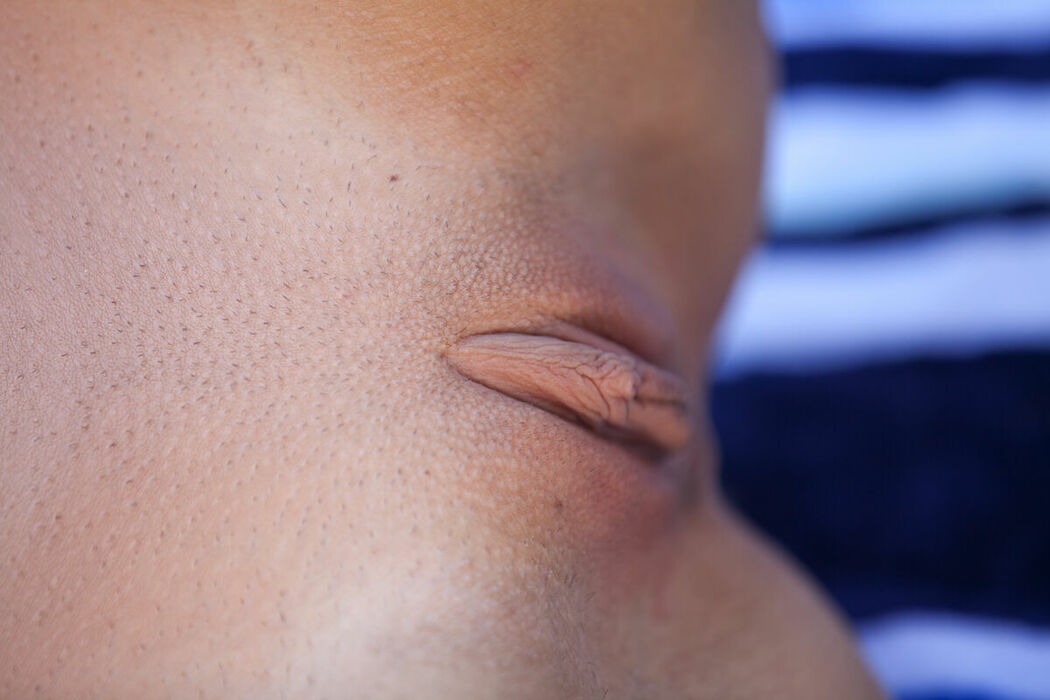 MetArt Malena Morgan – Amartia Part02 (70P)